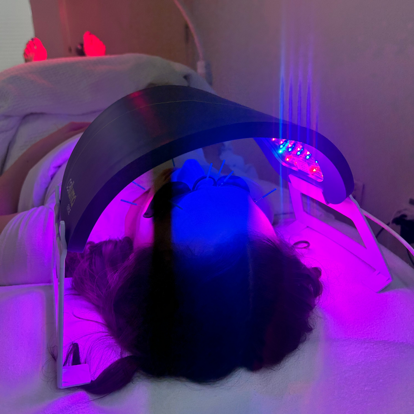 Acu Glow | Cosmetic Acupuncture